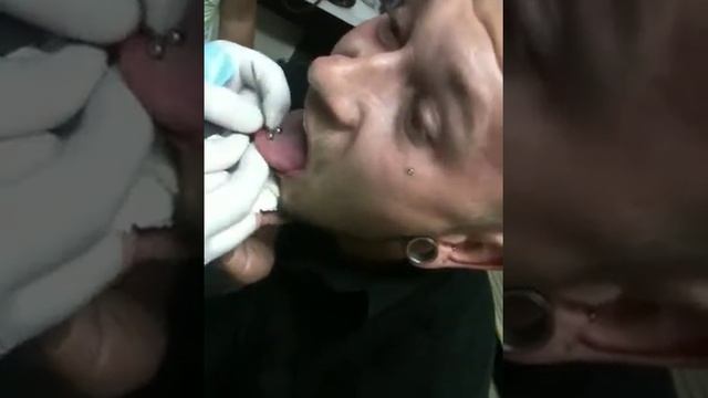 Tongue piercing